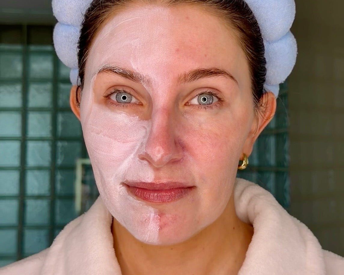 Nappy cream on your face?