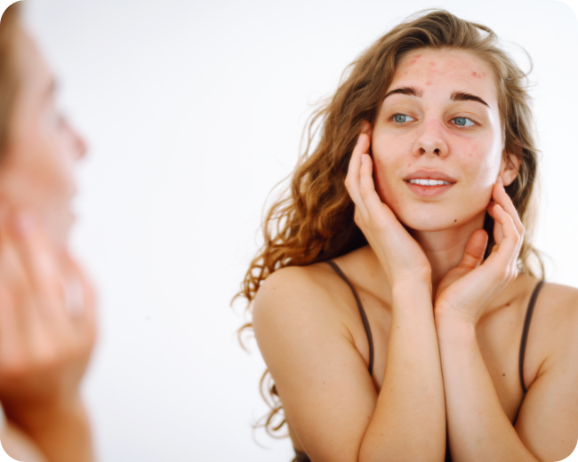 Breakouts in Summer? Your Cleanser Could Be to Blame