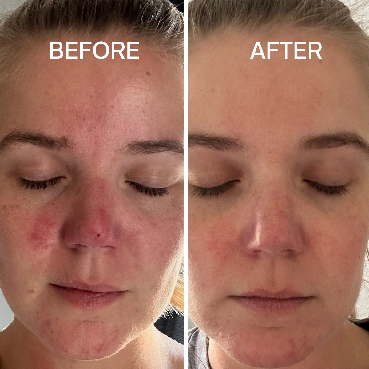 Sensitive Skin Regime