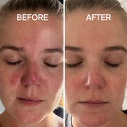 Sensitive Skin Regime