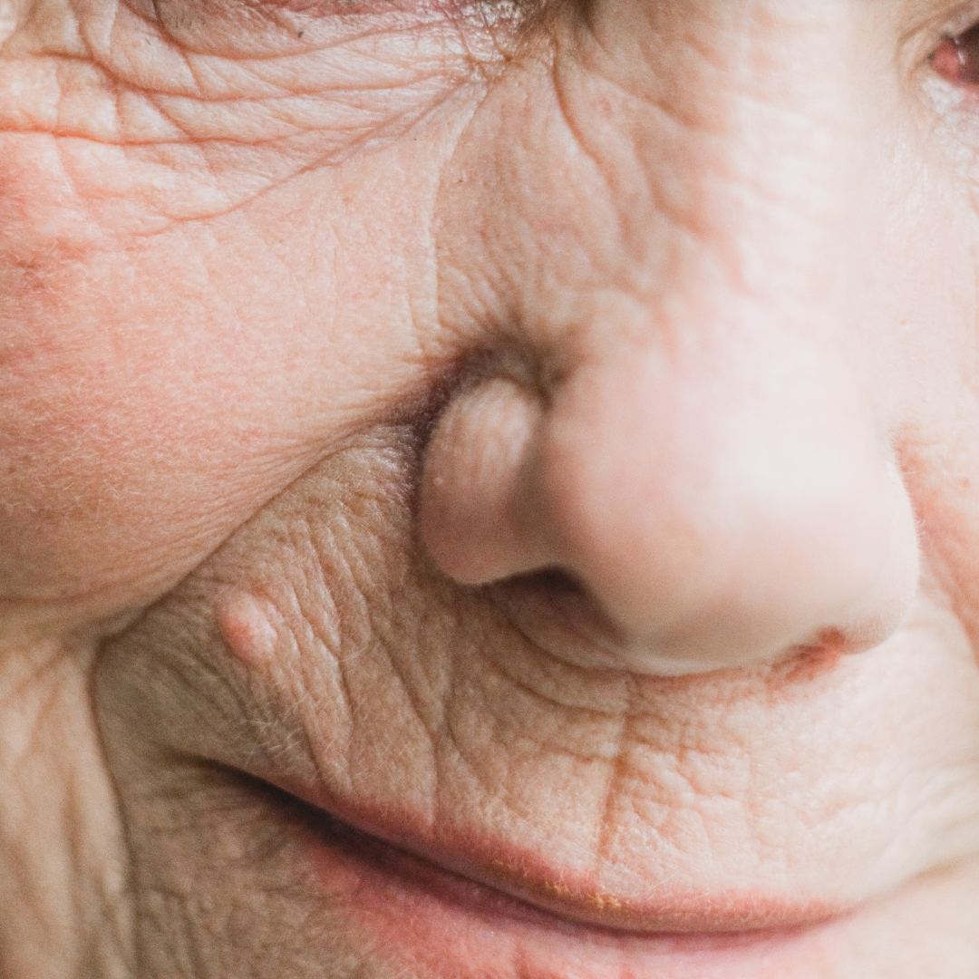 Anti-Ageing.png