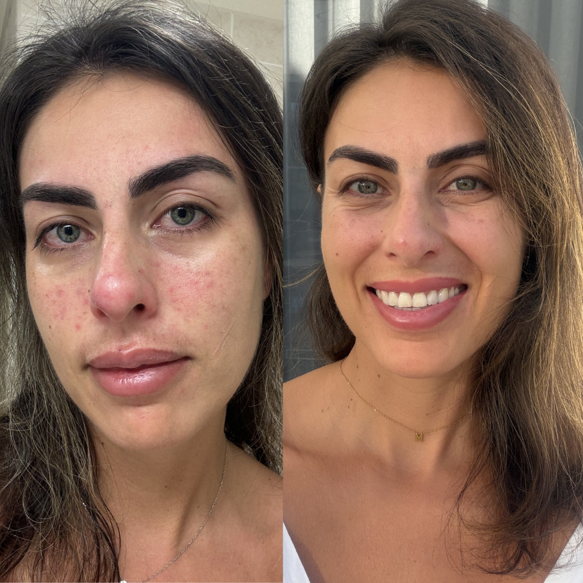 Antioxidant Serum
