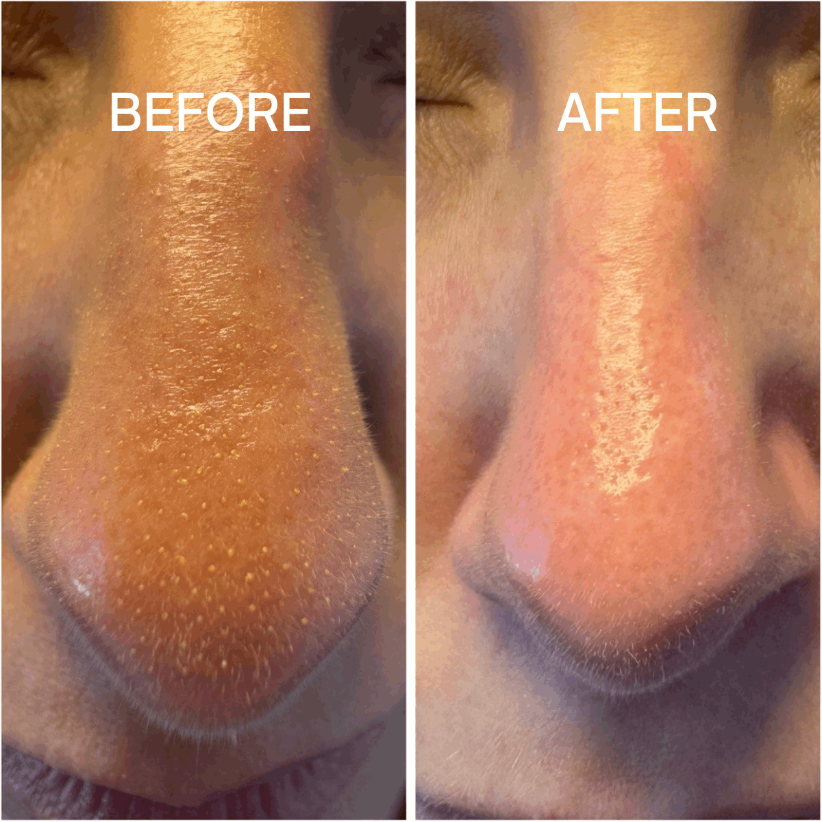 Before Treatment After Treatment 