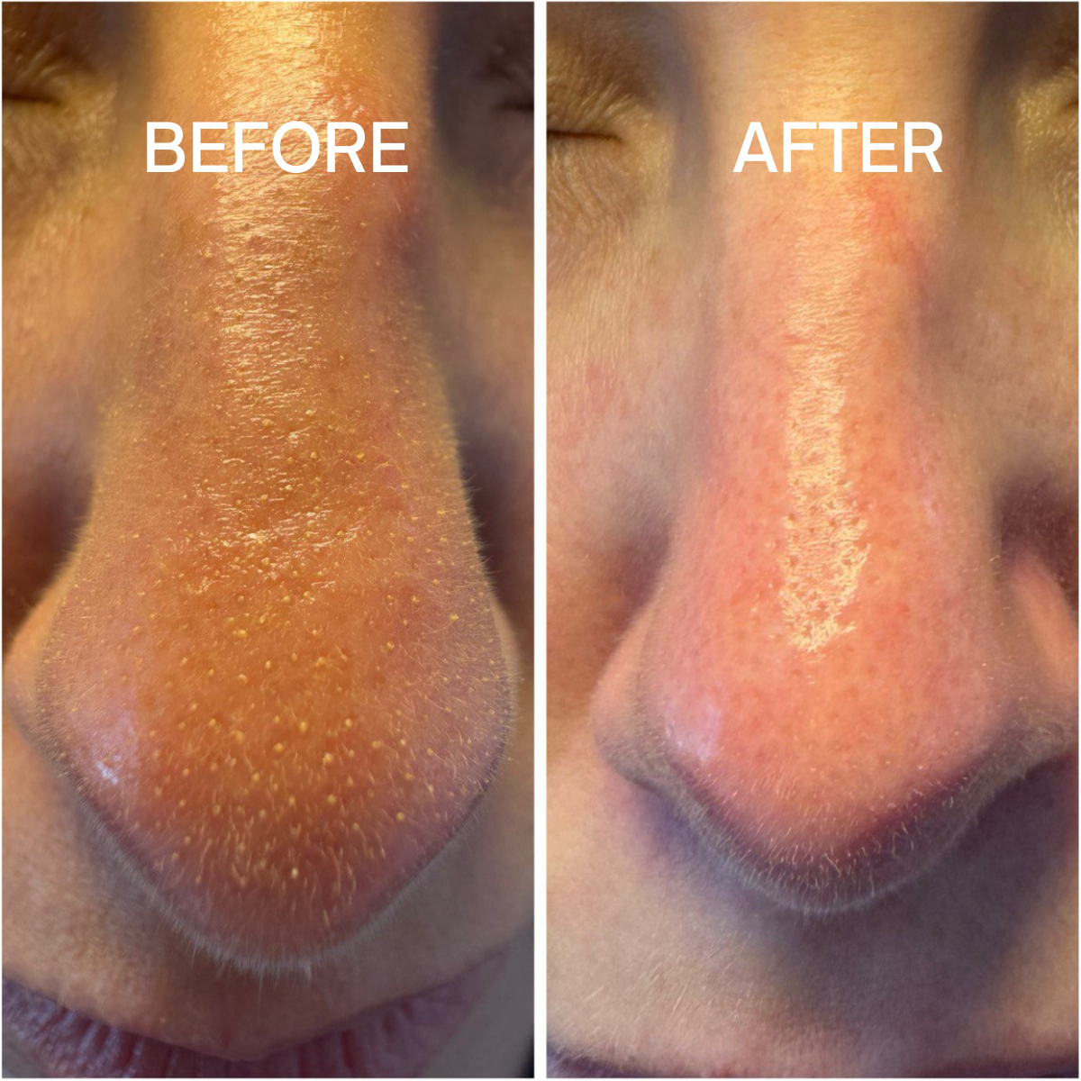 Deep Cleanser