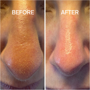 Deep Cleanser