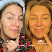 Barrier Recovery Cream - NEW
