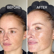 Visibly brighter more luminous skin after using Bloc Antioxidant Serum