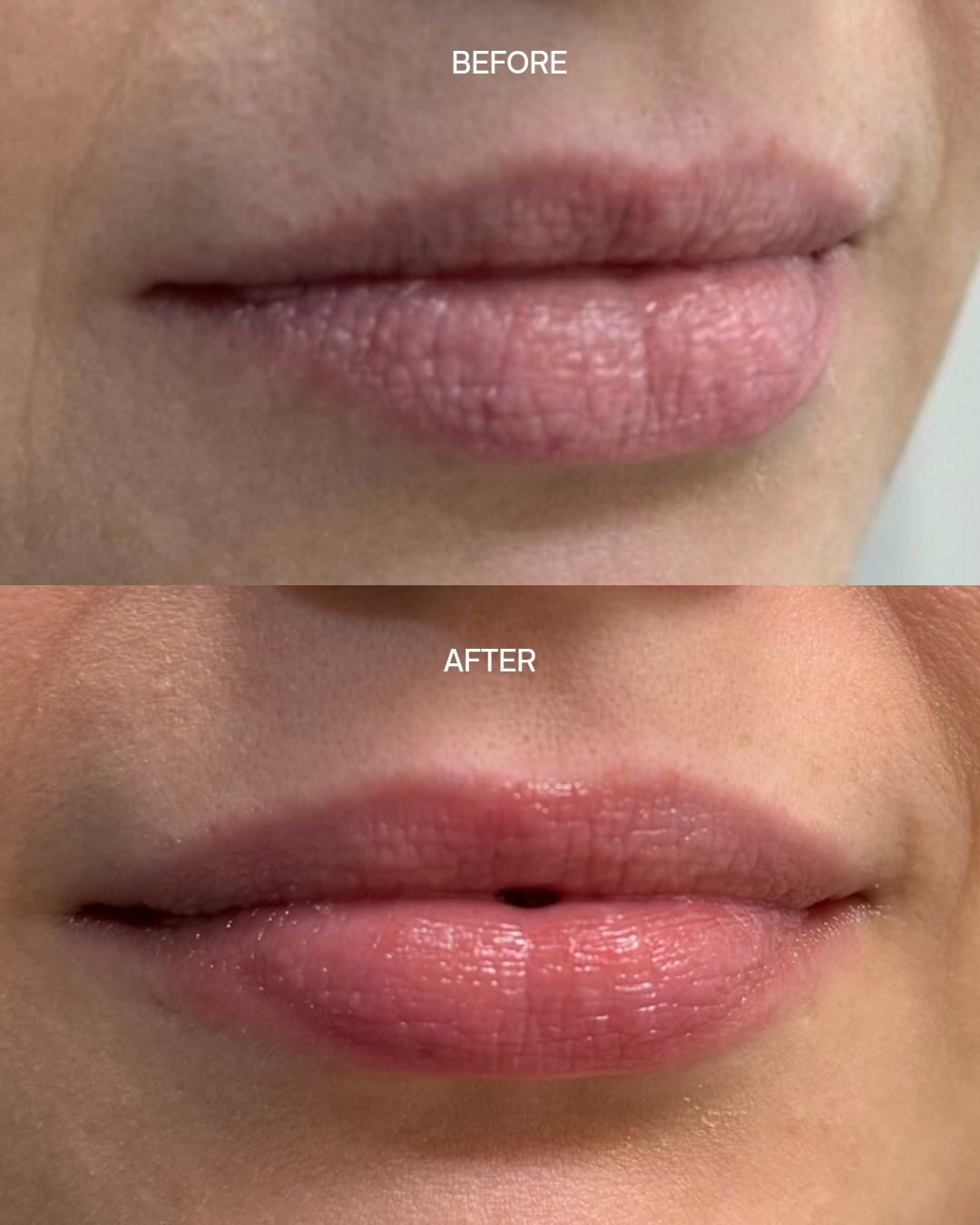 Pro-Lip Balm - Bloc Skincare - Dry lips - before and after results