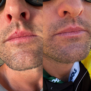 Pro-Lip Balm