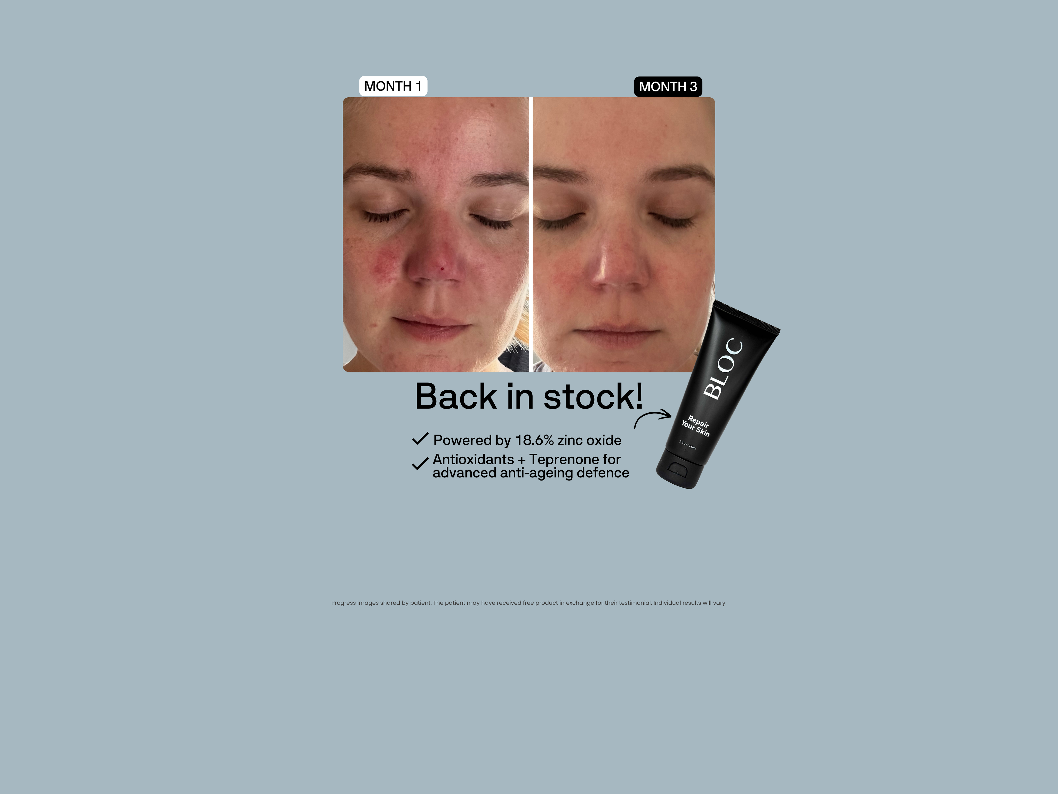 Repair_your_skin_MOB_afd2f505-9521-4e88-abba-8444130ba1eb.png